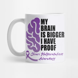 Chiari Malformation Awareness Purple Ribbon MY BRAIN IS BIGGER I HAVE PROOF Mug